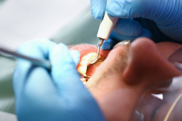Best Tooth Infection Emergency Dentist  in Thorp, WI