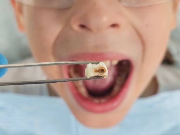 Best Chipped Tooth Repair Near Me  in Thorp, WI